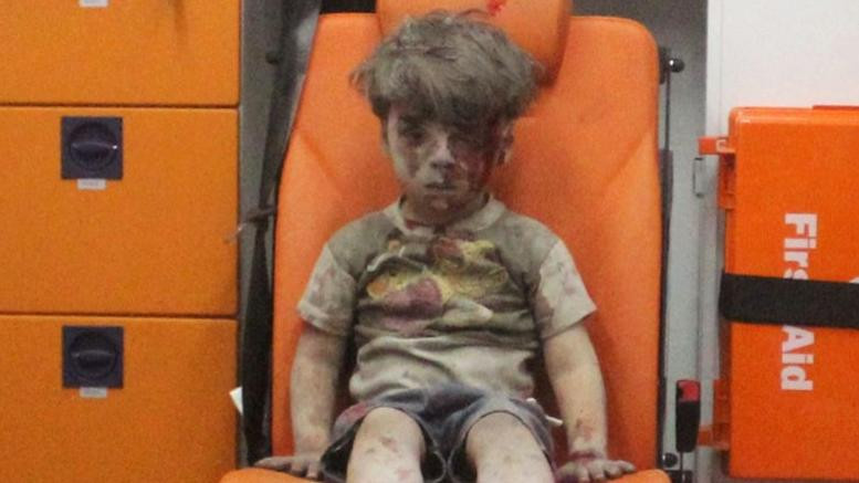 Ομράν: Δείτε το παιδί – σύμβολο του πολέμου ένα χρόνο μετά (εικόνες)